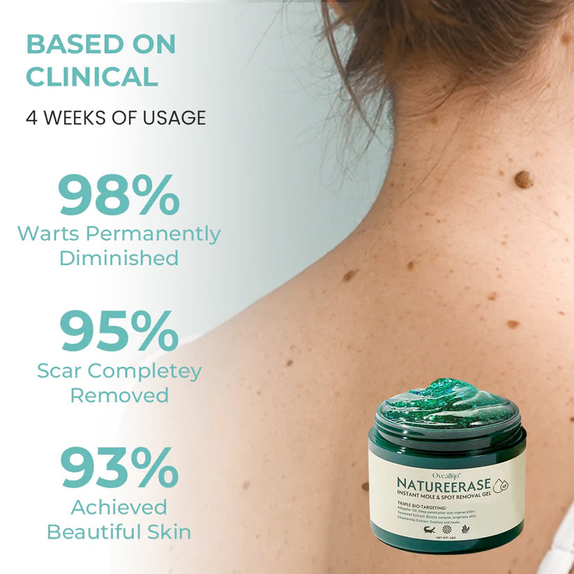 NatureErase gel za takojšnje odstranjevanje madežev in madežev