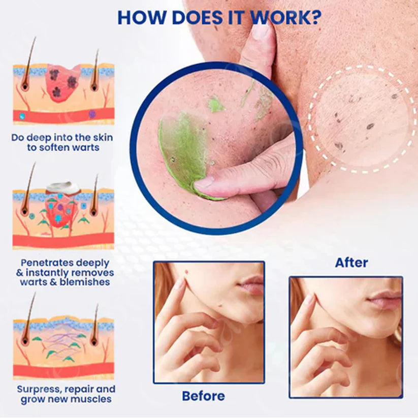 NatureErase gel za takojšnje odstranjevanje madežev in madežev