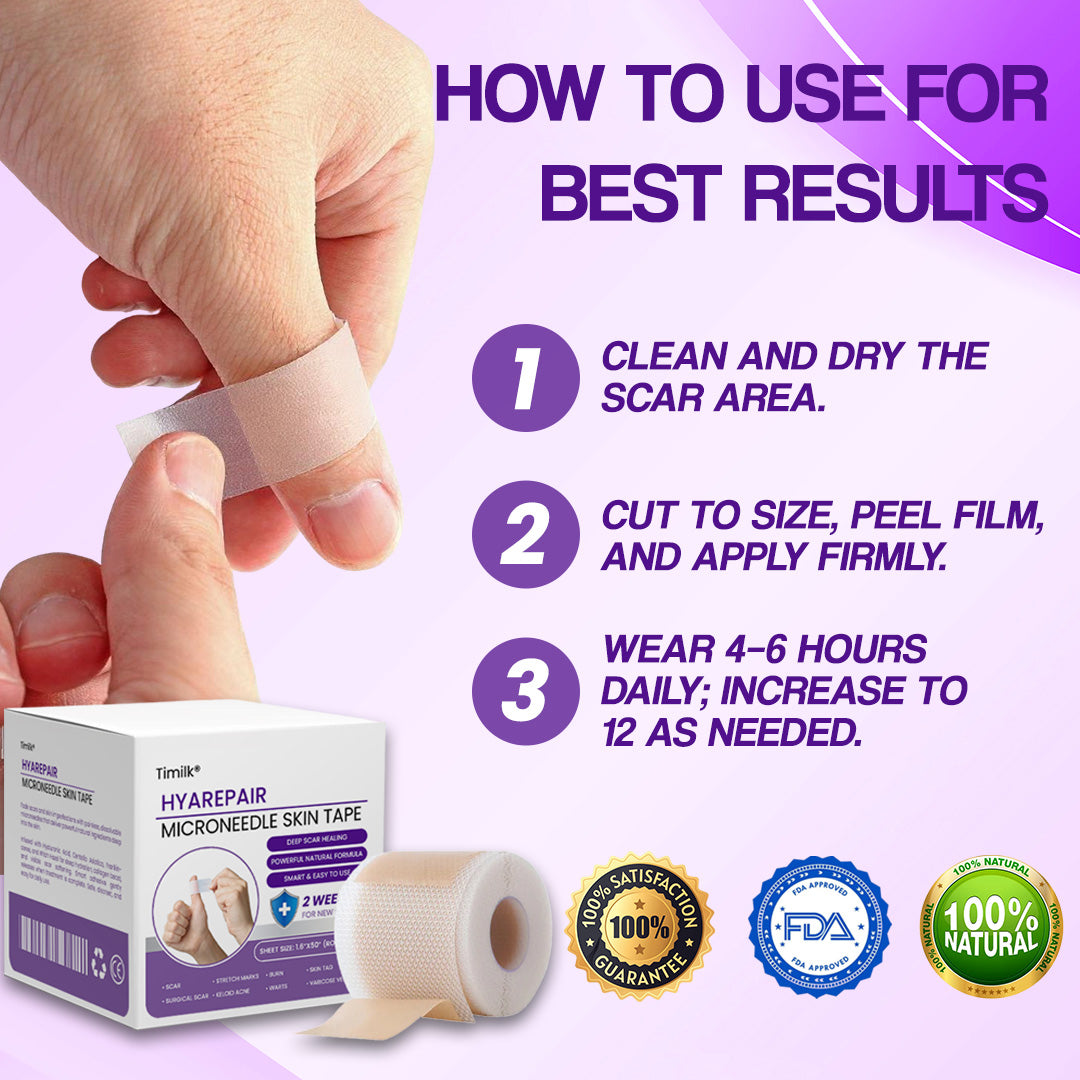 Mikroigelni kožni trak