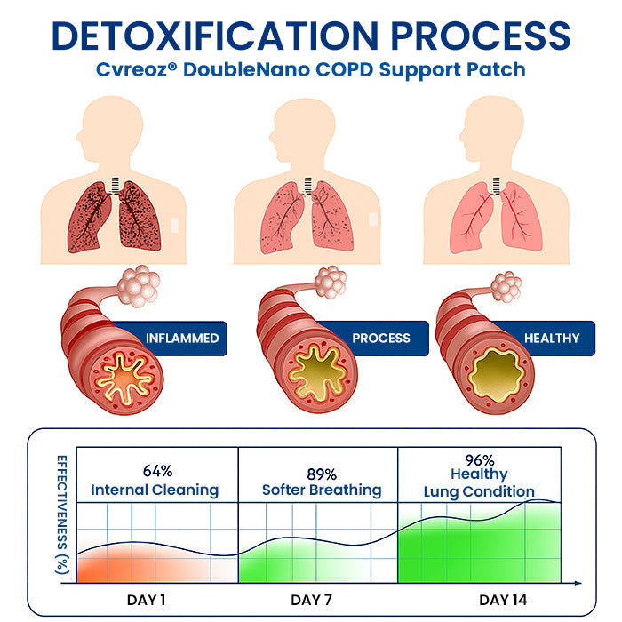 Obliži za podporo pljuč