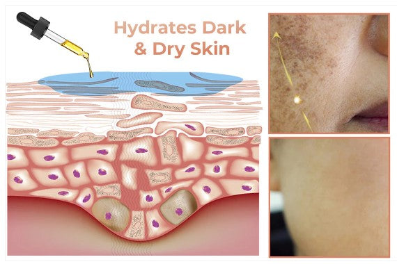 Obrazni serum za hitro odstranjevanje temnih madežev za korekcijo melanina