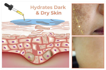 Obrazni serum za hitro odstranjevanje temnih madežev za korekcijo melanina