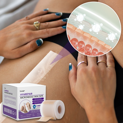 Mikroigelni kožni trak