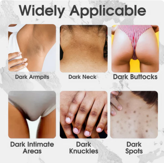 SnowBleach™ belilna krema za telo