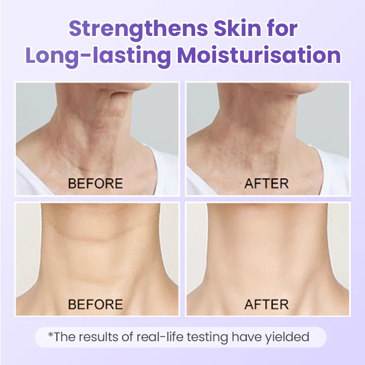 Obliž proti gubam za vrat s peptidi