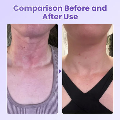 Obliž proti gubam za vrat s peptidi