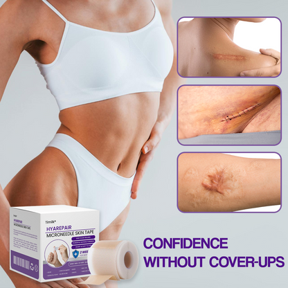 Mikroigelni kožni trak