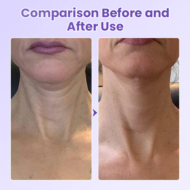 Obliž proti gubam za vrat s peptidi