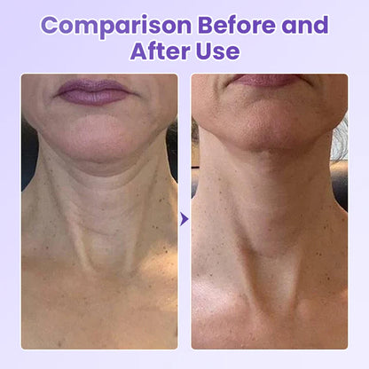 Obliž proti gubam za vrat s peptidi