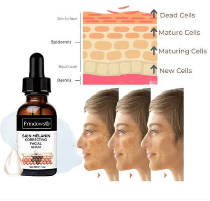 Obrazni serum za hitro odstranjevanje temnih madežev za korekcijo melanina
