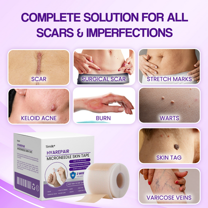 Mikroigelni kožni trak