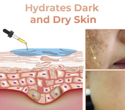 Obrazni serum za hitro odstranjevanje temnih madežev za korekcijo melanina