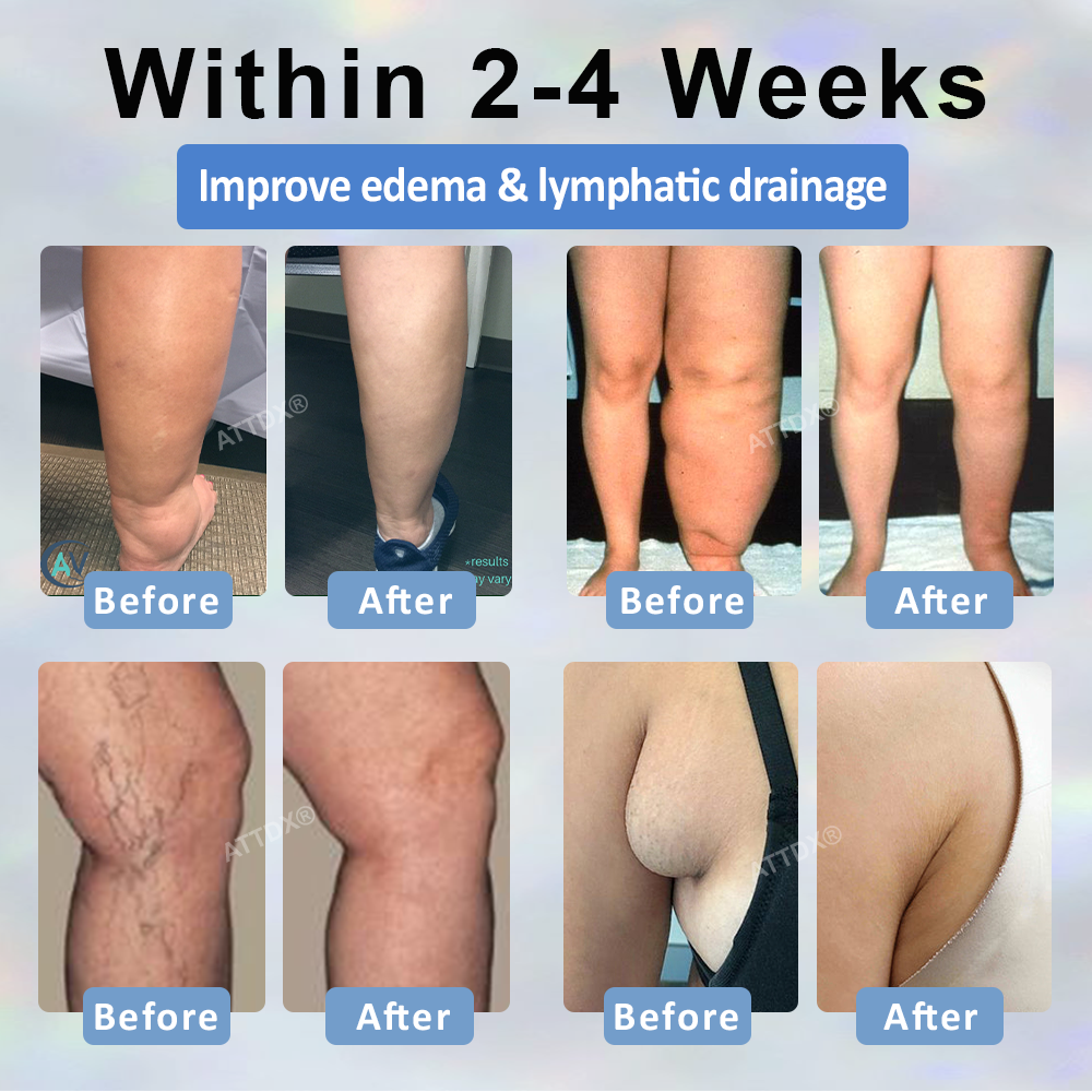 Razstrupljevalna krema s črno kumino