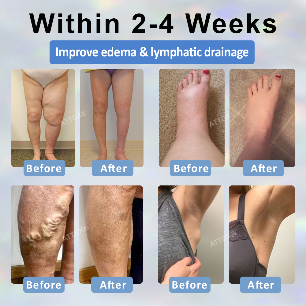 Razstrupljevalna krema s črno kumino