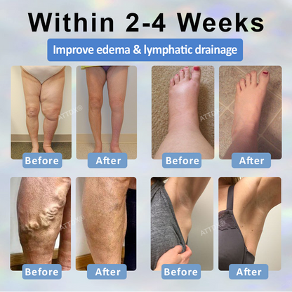 Razstrupljevalna krema s črno kumino