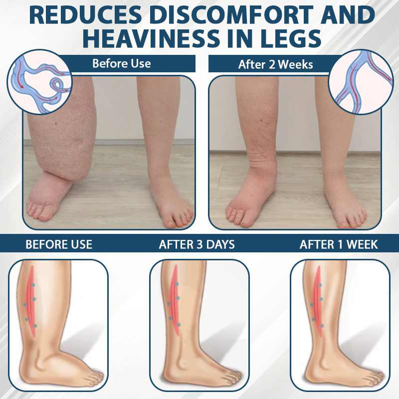 Razstrupljevalna krema s črno kumino