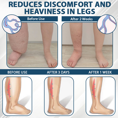 Razstrupljevalna krema s črno kumino