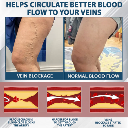 Razstrupljevalna krema s črno kumino