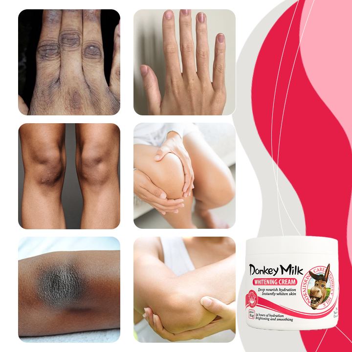 SnowBleach™ belilna krema za telo